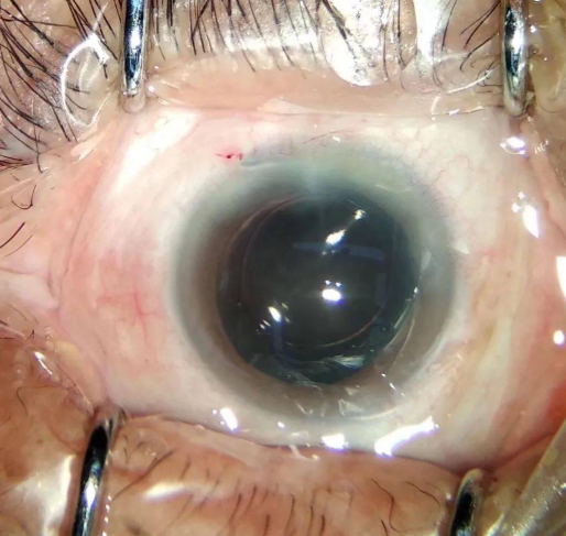 視力加盟,視力連鎖,視力保健